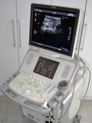 Używany ultrasonograf Toshiba Aplio MX SSA-780A