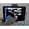 Ultrasonograf aparat USG -  przenośna głowica iuStar180 United Imaging