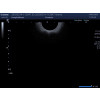 Głowica sonda endowginalna USG Toshiba Canon PVT-781VTE 11C3
