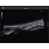 Ultrasonograf , aparat USG Toshiba XARIO SSA-660A 3D, ADF, obrazowanie panoramiczne