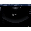 Głowica sonda USG Toshiba Canon PST-65AT, PST65AT 9S4 4.0-9.0 MHz