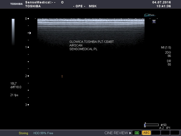 Głowica sonda liniowa USG Toshiba PLT-1204BT