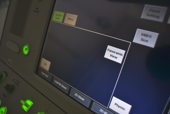 Ultrasonograf klasy PREMIUM USG Toshiba Xario XG SSA-680A CW Doppler UKG