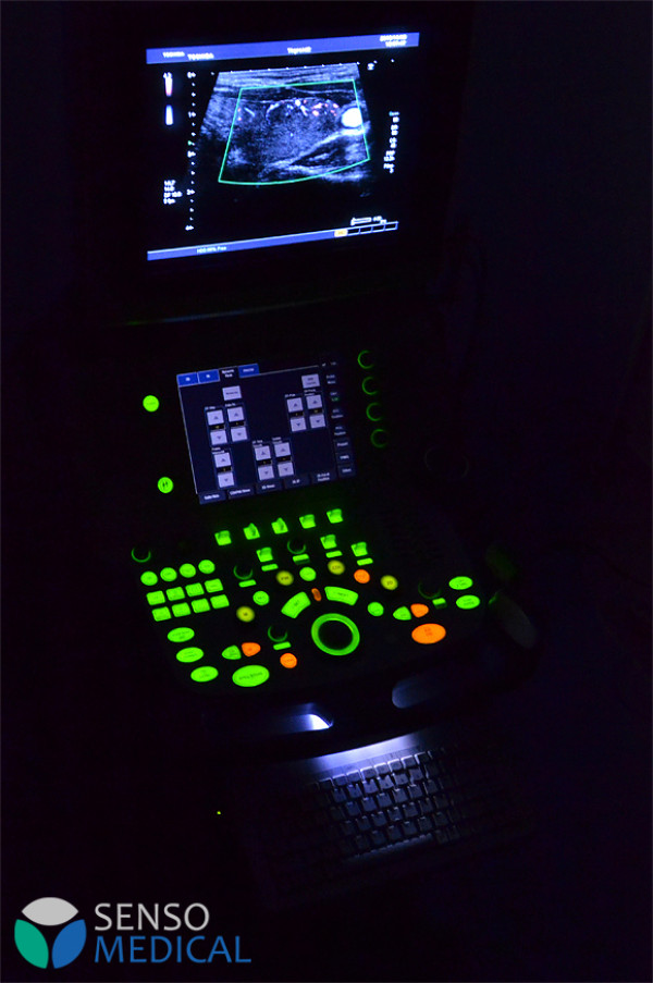 Ultrasonograf , aparat USG Toshiba XARIO SSA-660A 3D, ADF, obrazowanie panoramiczne