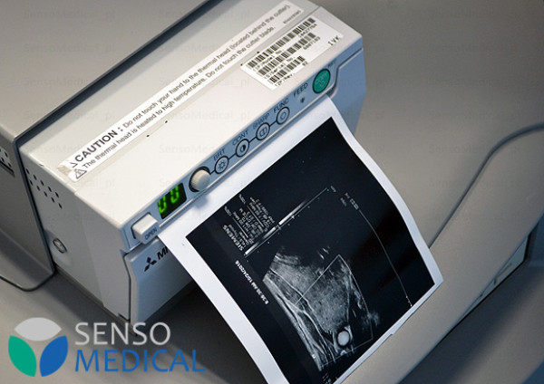 Ultrasonograf , aparat USG klasy PREMIUM Siemens S2000 z zaawansaowaną elastografią