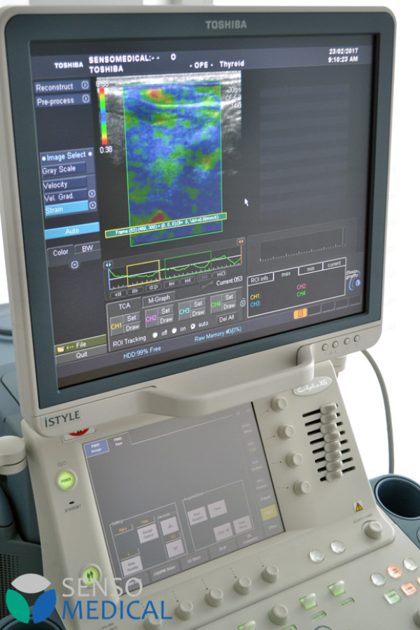 Używany ultrasonograf Toshiba Aplio XG SSA-790A z elastografią