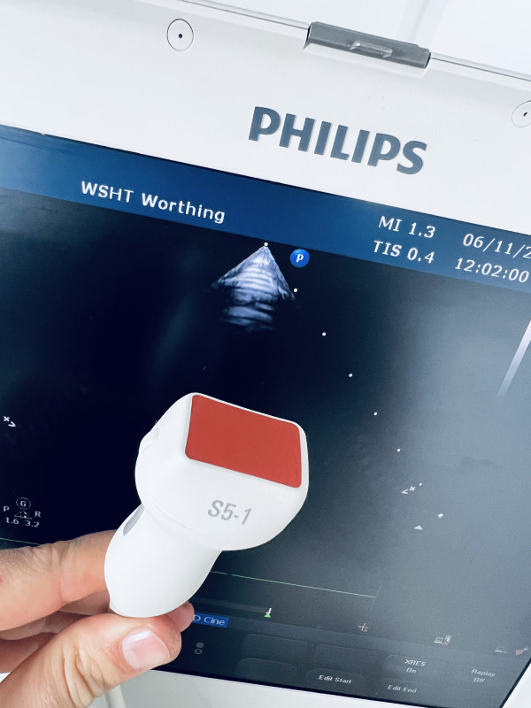 Ultrasonograf przenośny echokardiograf aparat UKG Philips CX50