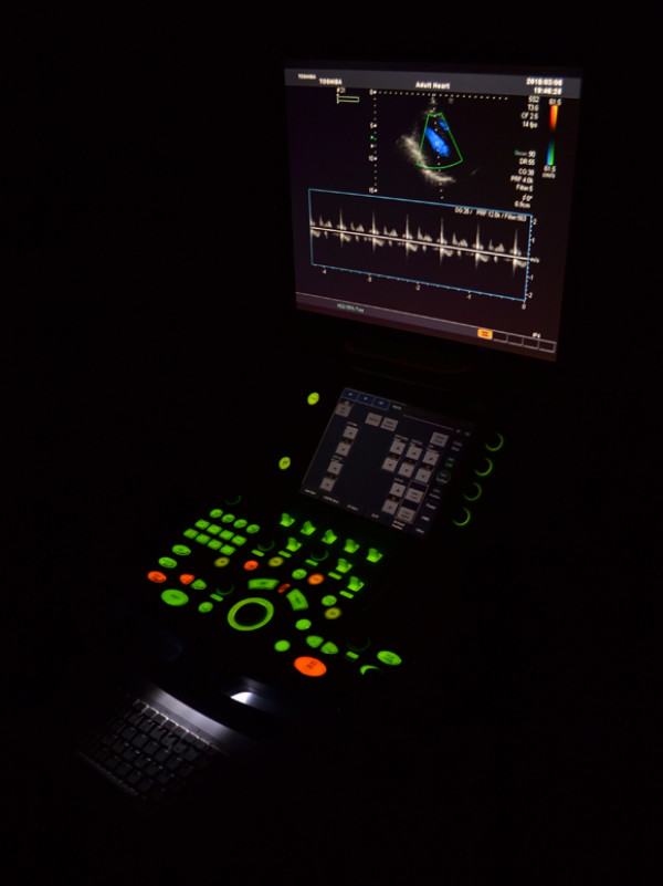 Ultrasonograf klasy PREMIUM Toshiba Xario SSA-660A z kardiologią CW