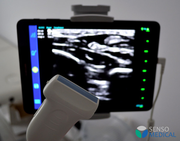 Ultrasonograf aparat USG -  przenośna głowica iuStar180 United Imaging