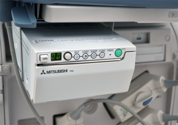 Ultrasonograf klasy PREMIUM USG Toshiba Xario XG SSA-680A CW Doppler UKG
