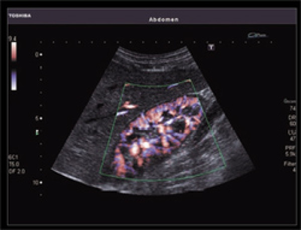 Ultrasonograf , aparat USG Toshiba XARIO SSA-660A 3D, ADF, obrazowanie panoramiczne