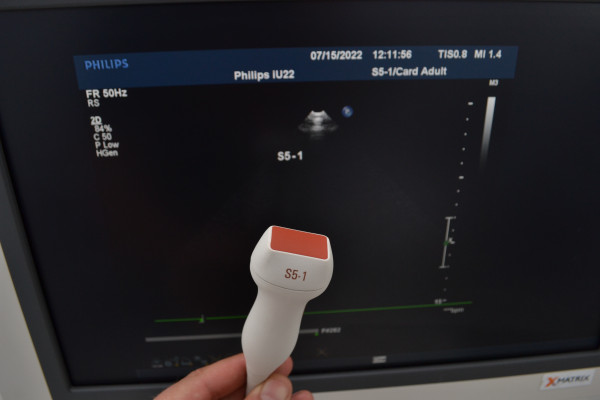 Ultrasonograf kadriologiczny  aparat USG Philips iu22