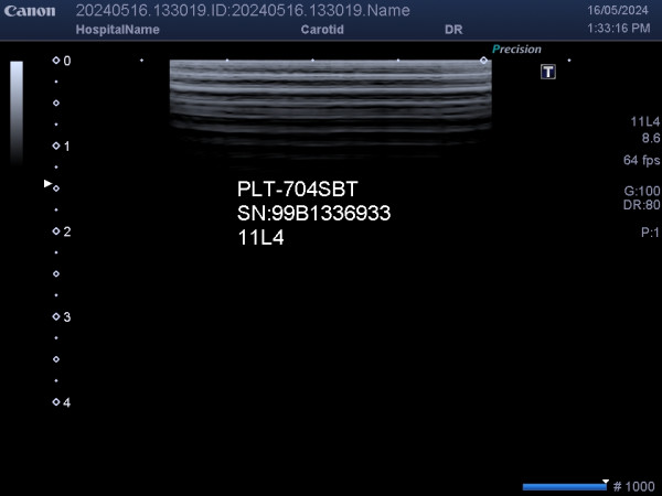 Głowica sonda liniowa USG Toshiba Canon PLT-704SBT 11L4