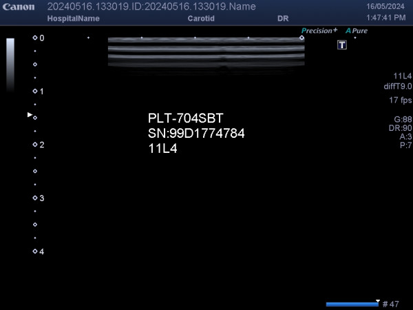 Używana głowica sonda liniowa USG Toshiba Canon PLT-704SBT 11L4
