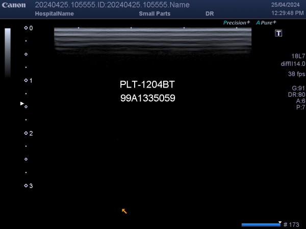 Głowica sonda liniowa USG Canon Toshiba PLT-1204BT 18L7 S15