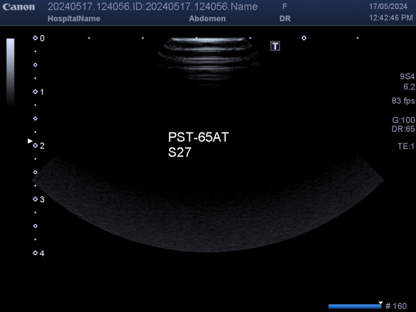 Głowica sonda USG Toshiba Canon PST-65AT, PST65AT 9S4 4.0-9.0 MHz