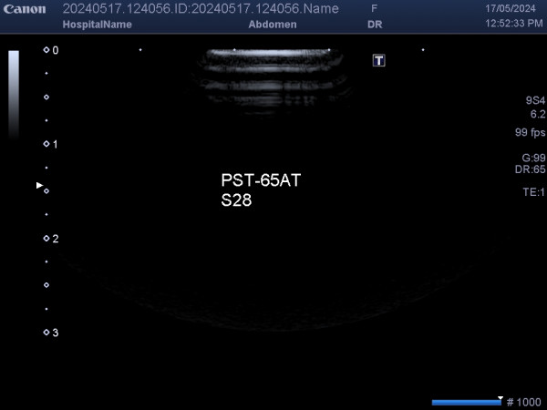 Głowica sonda USG Toshiba Canon PST-65AT, PST65AT 9S4